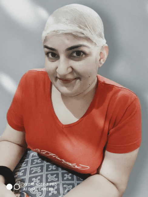 Is Alopecia Areata is curable